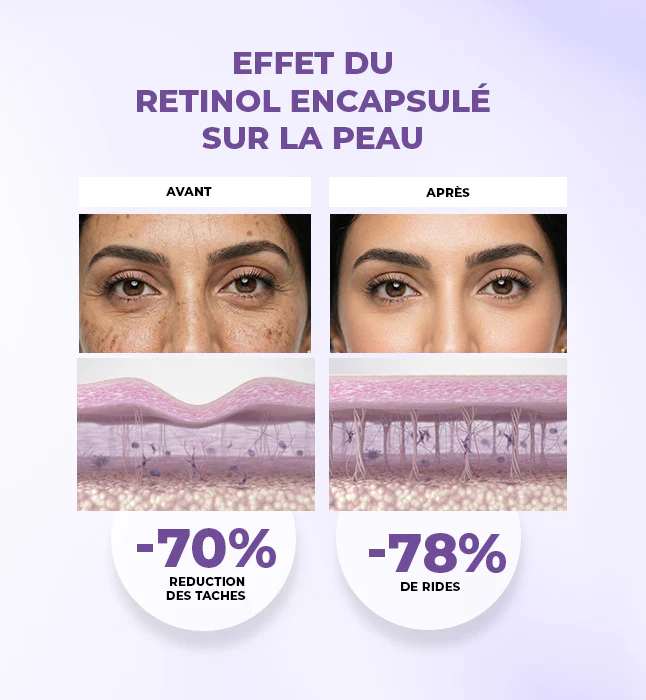 Gleamy Retinol Encapsule Regenerant 40ml - Image 3